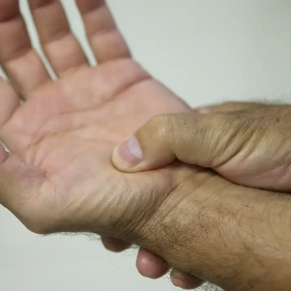 Lei federal reconhece fibromialgia como deficiência e amplia direitos a partir de 2026